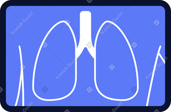 lung x-ray PNG, SVG