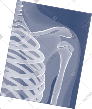 X-ray PNG, SVG