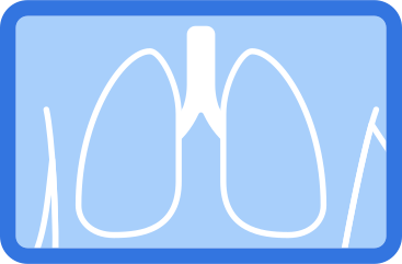 Radiografia pulmonar PNG, SVG