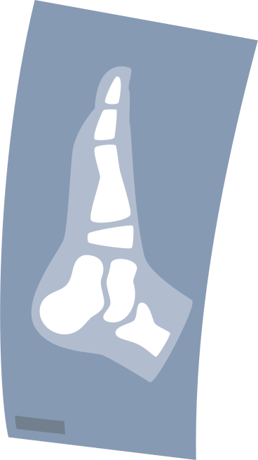 x-ray leg PNG, SVG